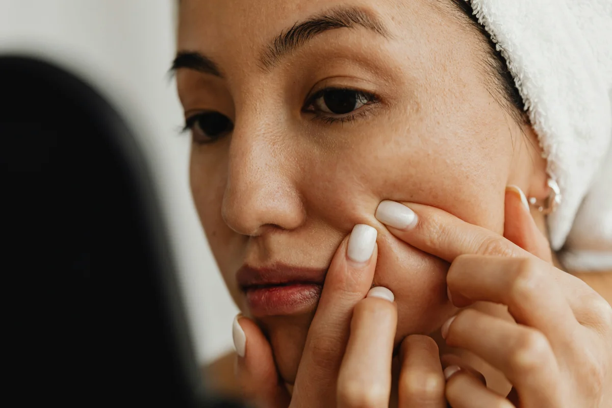 Headergrafik Blackheads