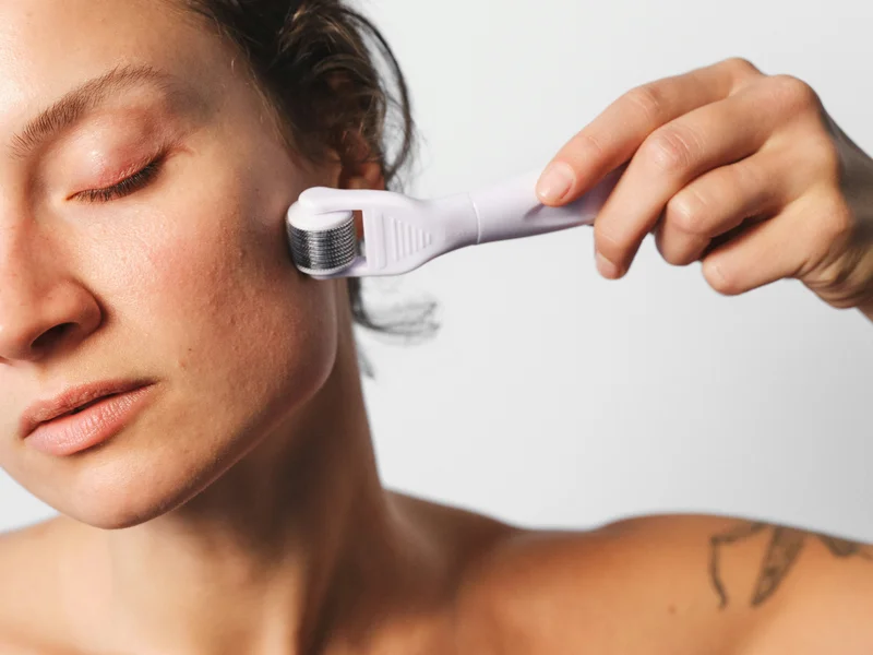 Frau mit Microneedling Tool in der Hand
