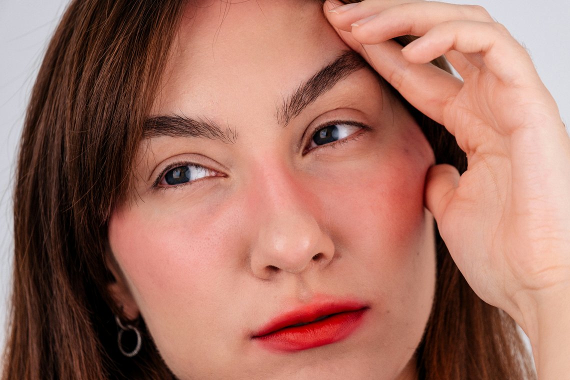 Nahaufnahme Gesicht einer Frau mit Sunburn-Makeup Nahaufnahme Gesicht einer Frau mit Sunburn-Makeup