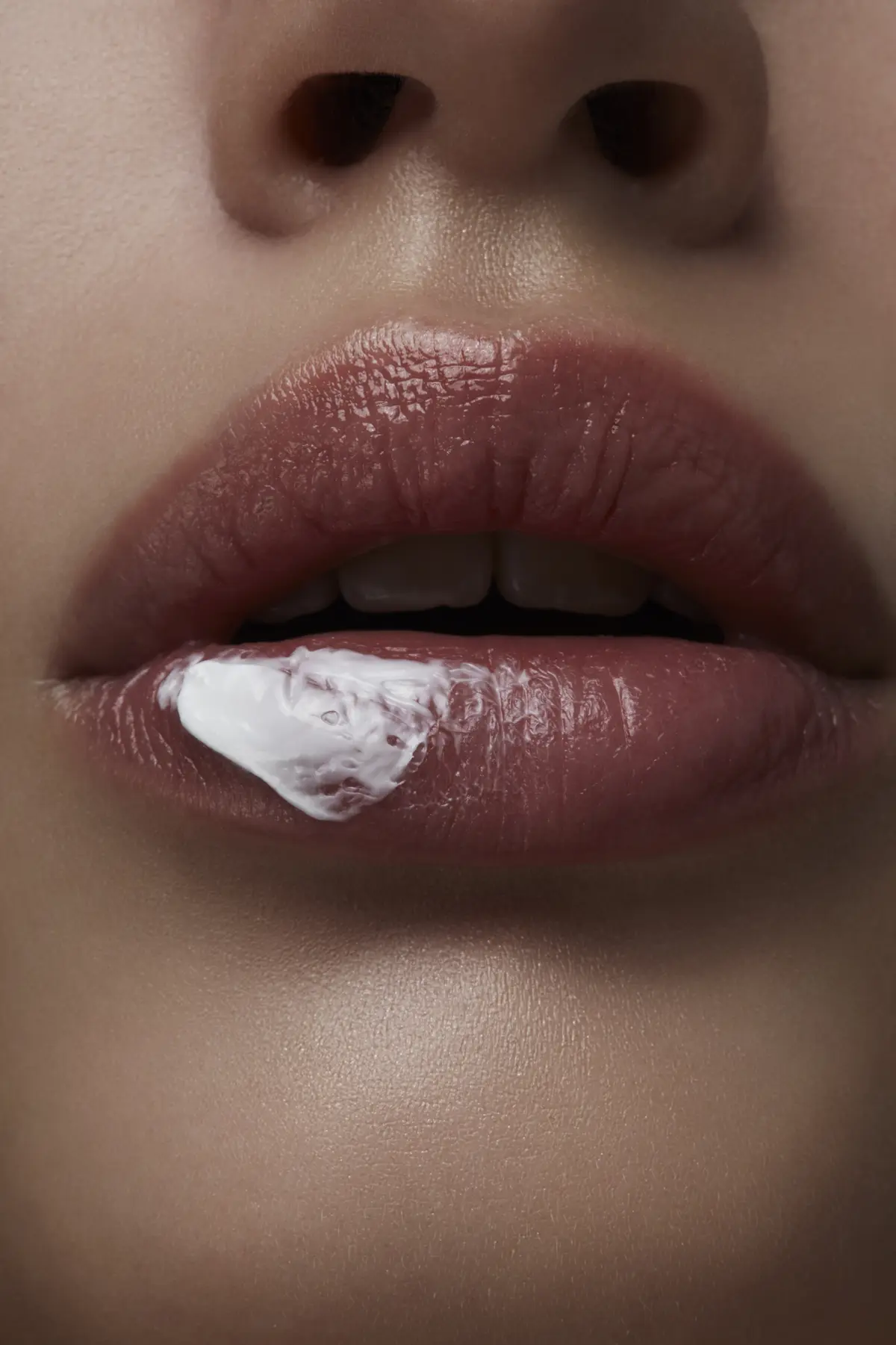 SOS-Hilfe bei Lippenherpes