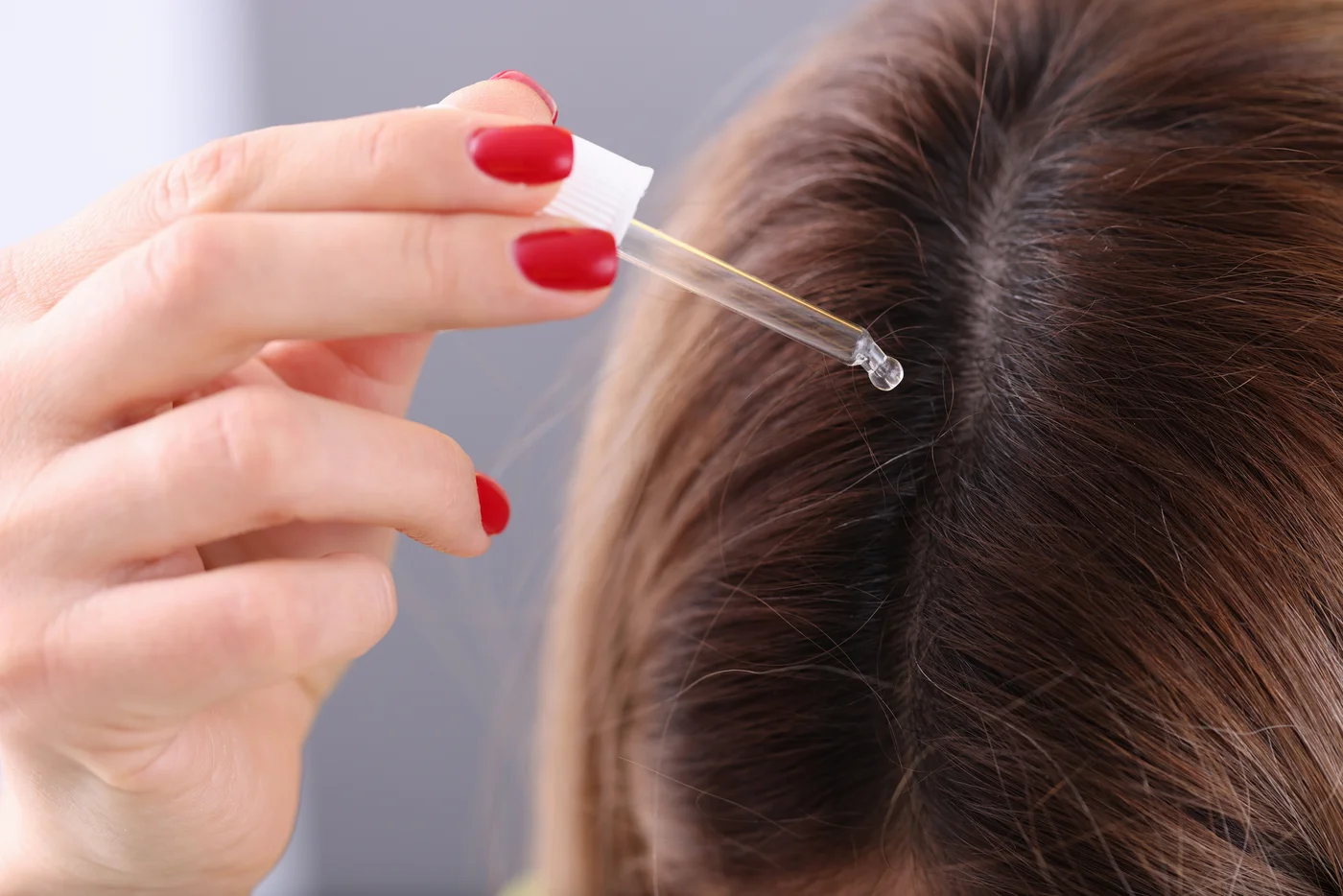 Nahaufnahme, Verdünntes Teebaumöl wird mit einer Pipette auf den Scheitel getropft