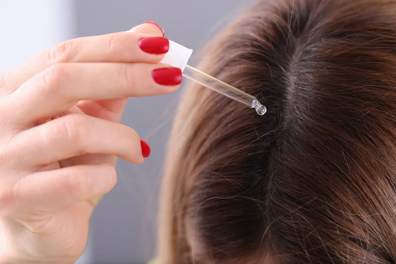 Nahaufnahme, Verdünntes Teebaumöl wird mit einer Pipette auf den Scheitel getropft