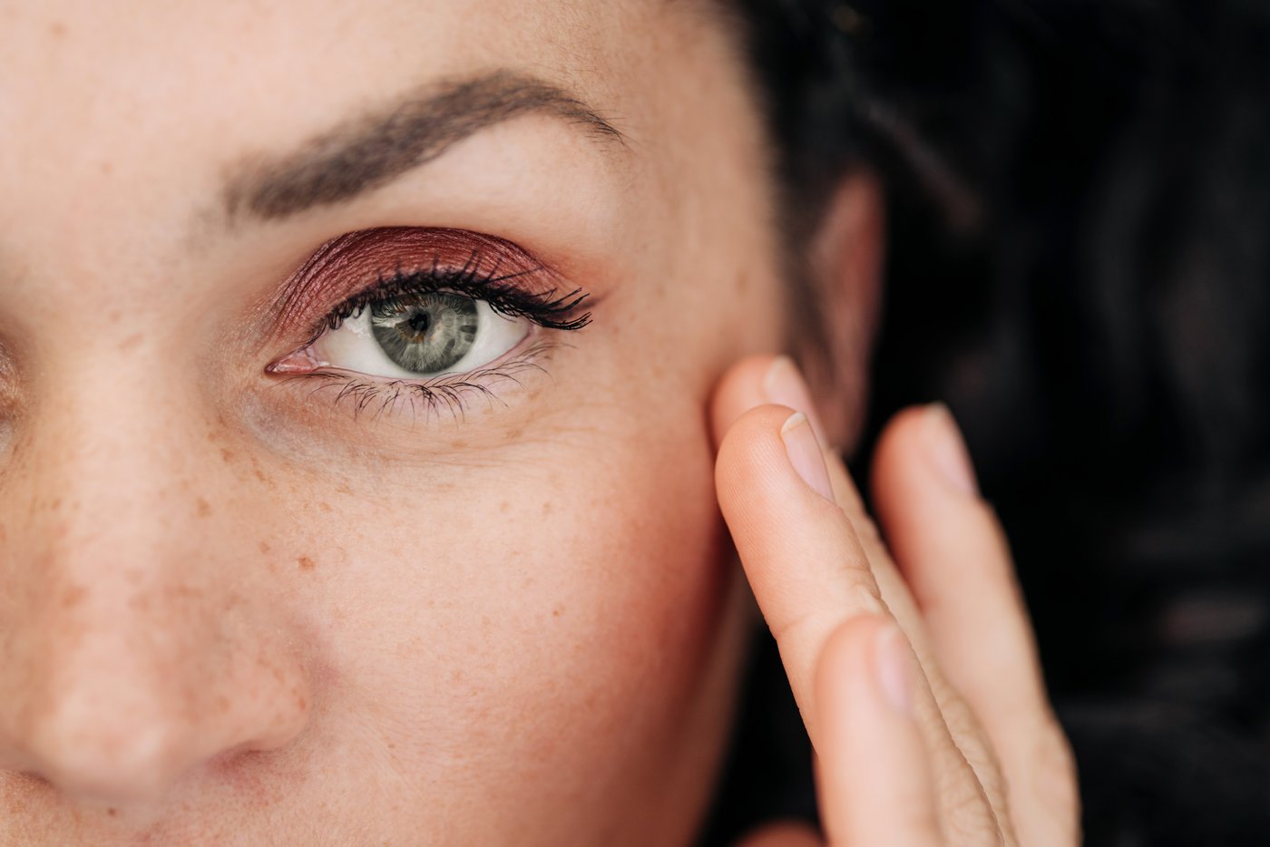 Sculptra Behandlung