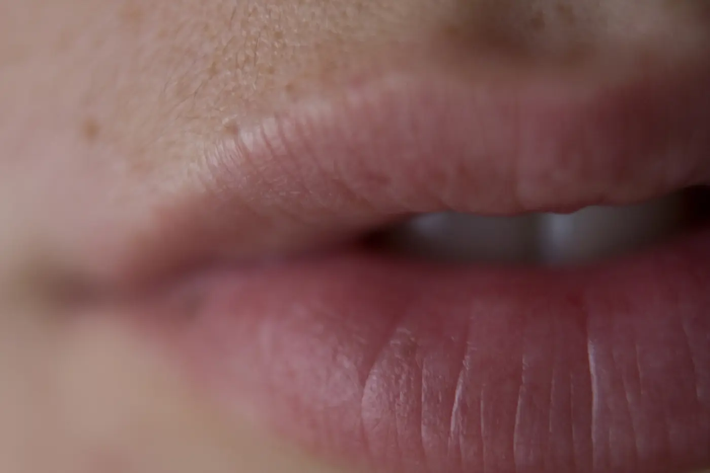 Trockene Lippen