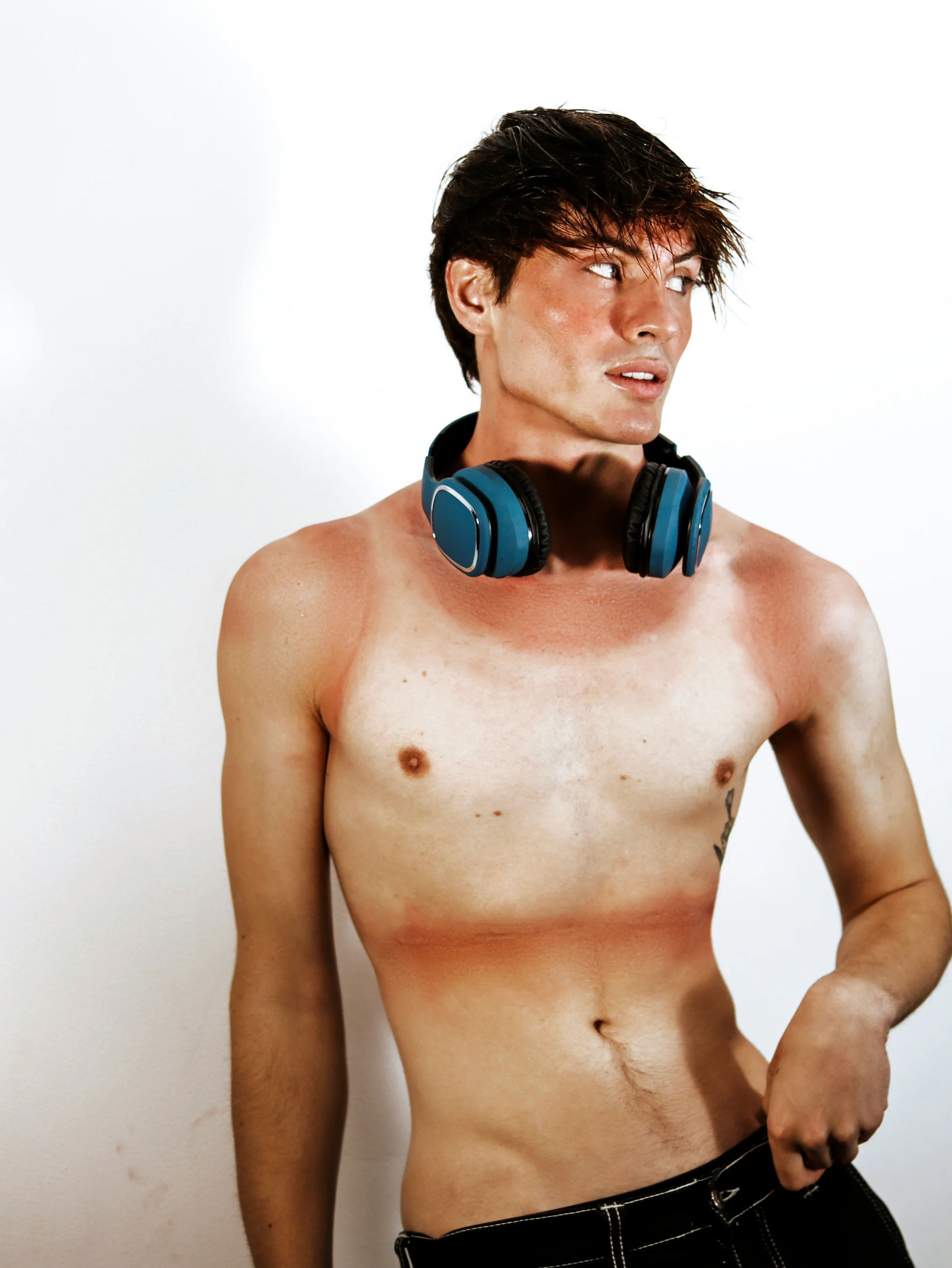 Junger Mann mit deutlichen Tan Lines an Schultern und Brust – Bräunungsstreifen nach dem Sonnenbad