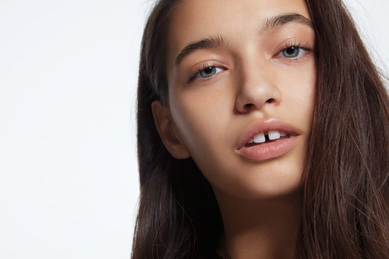 Model Azlin ungeschminkt