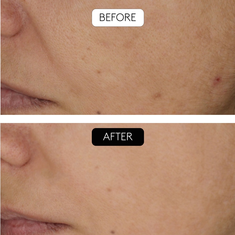 Close-up Mundbereich, vorher-nachher Aufnahme